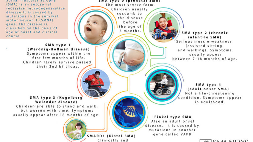 SMA (Spinal Muscular Atrophy) is the No.1 Genetic Killer of Babies and Infants!